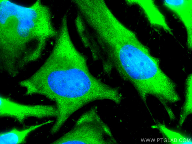 LDHB Antibody in Immunocytochemistry (ICC/IF)