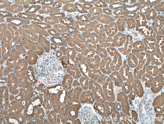 LDHB Antibody in Immunohistochemistry (Paraffin) (IHC (P))