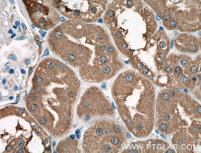 LDHB Antibody in Immunohistochemistry (Paraffin) (IHC (P))