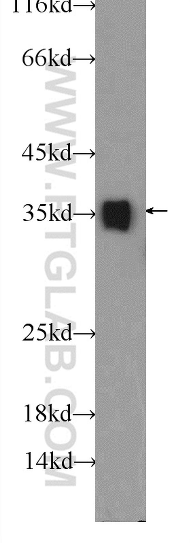 LDHB Antibody in Western Blot (WB)