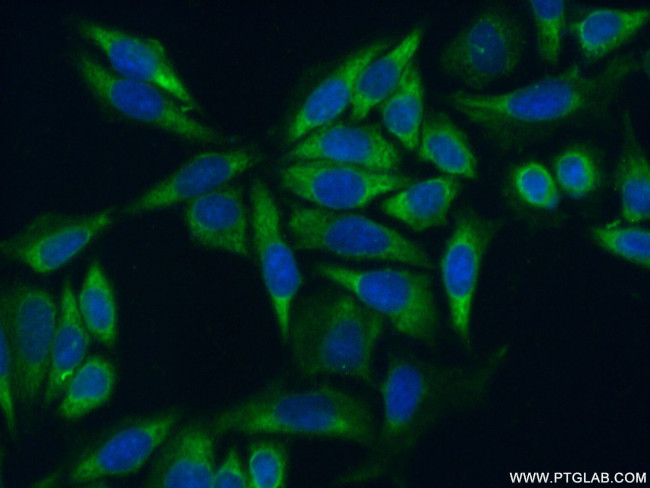 RPL35 Antibody in Immunocytochemistry (ICC/IF)