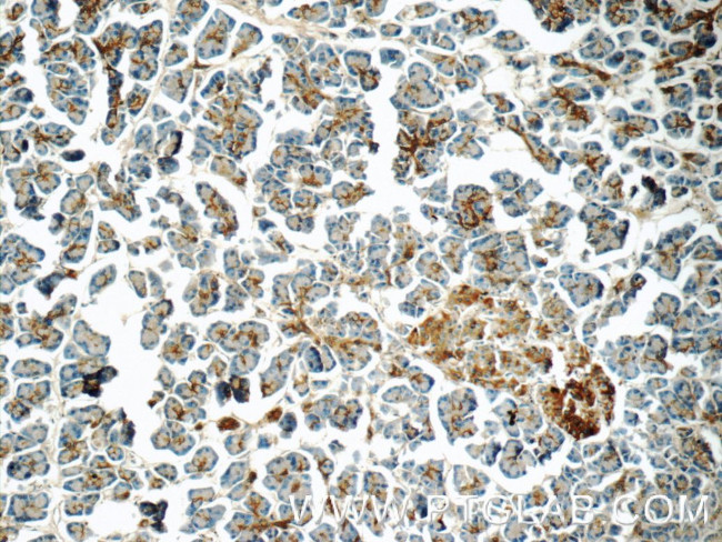 CRISP3 Antibody in Immunohistochemistry (Paraffin) (IHC (P))