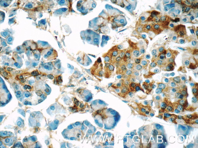 CRISP3 Antibody in Immunohistochemistry (Paraffin) (IHC (P))