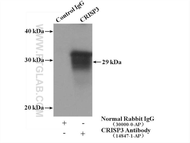 CRISP3 Antibody in Immunoprecipitation (IP)