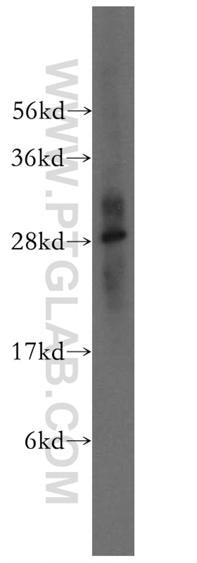 CRISP3 Antibody in Western Blot (WB)