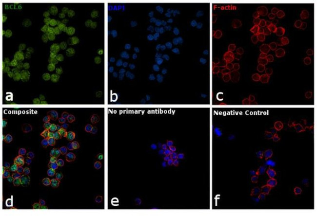 BCL6 Antibody in Immunocytochemistry (ICC/IF)