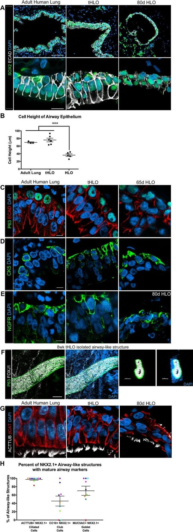 FOXJ1 Antibody in Immunohistochemistry (IHC)