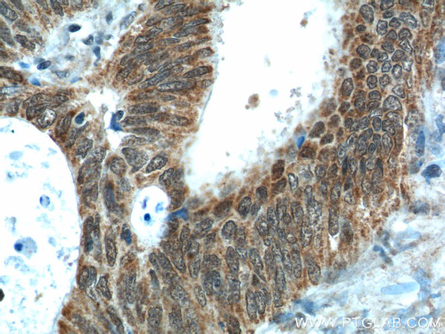 NUPR1 Antibody in Immunohistochemistry (Paraffin) (IHC (P))