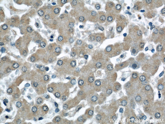 NUDT9 Antibody in Immunohistochemistry (Paraffin) (IHC (P))