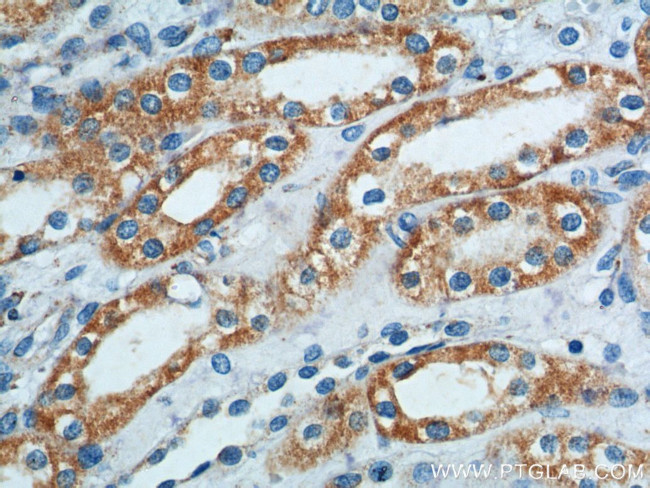 B4GALT4 Antibody in Immunohistochemistry (Paraffin) (IHC (P))