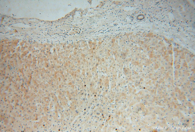 MRPL34 Antibody in Immunohistochemistry (Paraffin) (IHC (P))