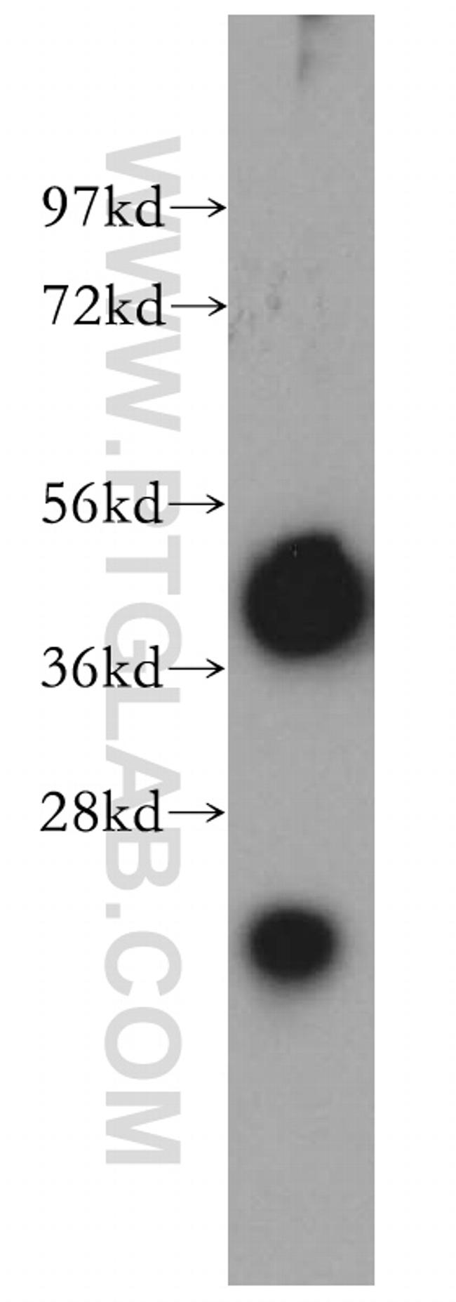TMOD2 Antibody in Western Blot (WB)