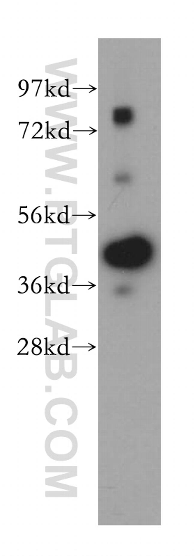 TMOD2 Antibody in Western Blot (WB)