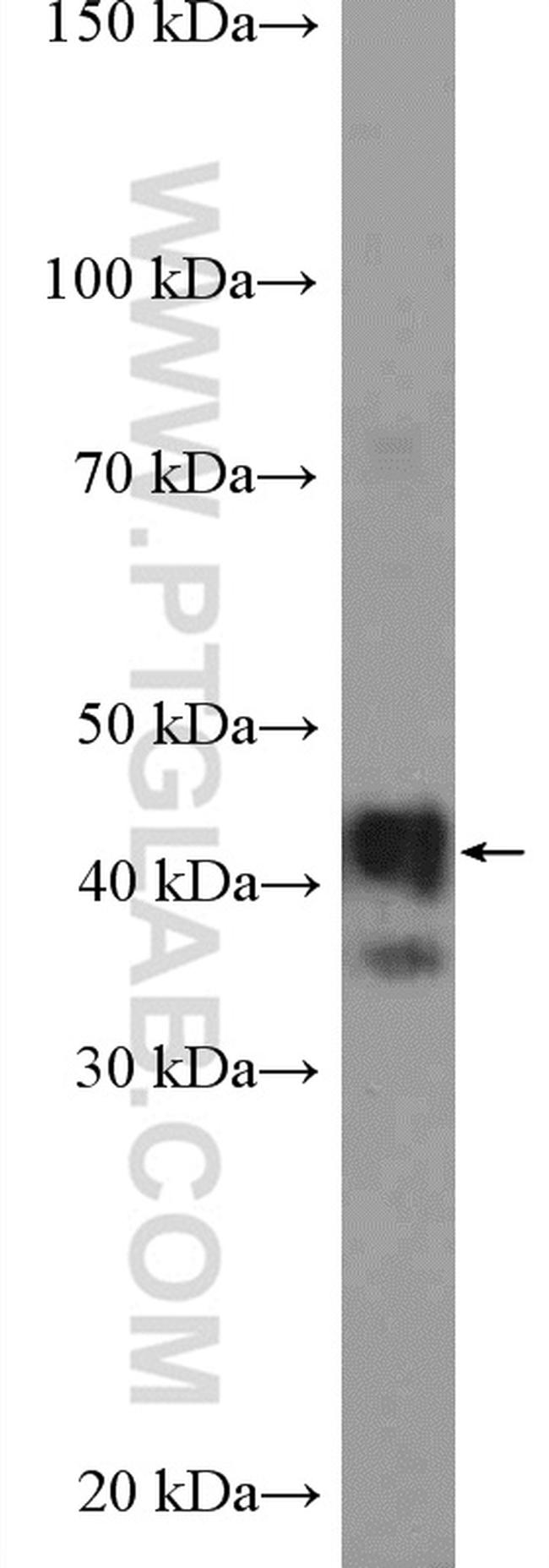 TMOD2 Antibody in Western Blot (WB)