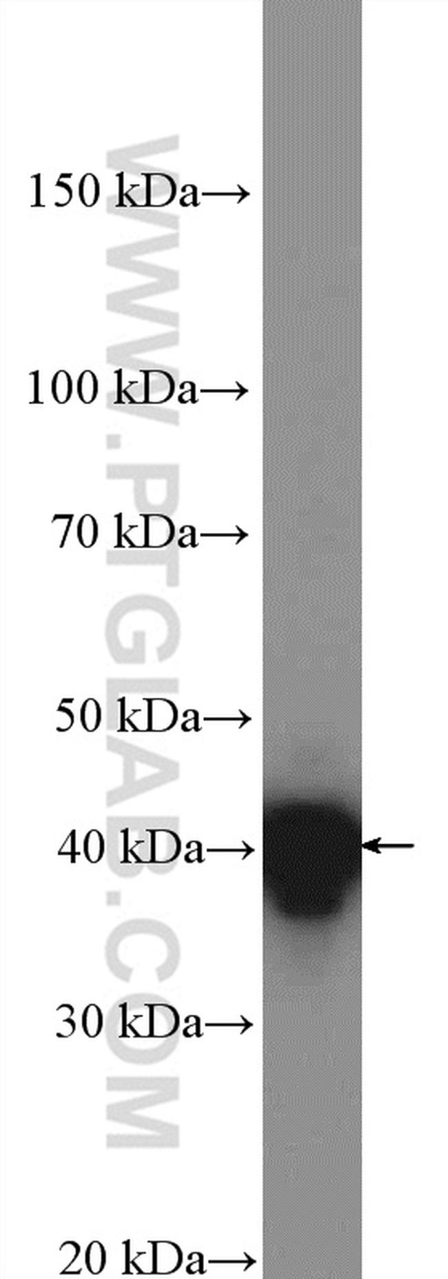 TMOD2 Antibody in Western Blot (WB)