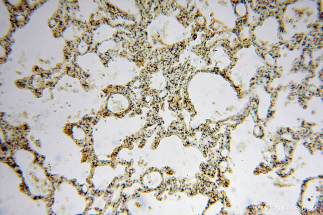 PCDHA5 Antibody in Immunohistochemistry (Paraffin) (IHC (P))