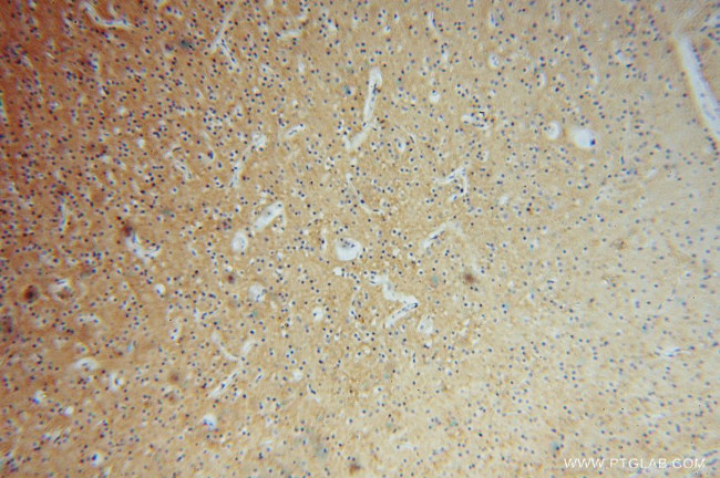 PCDHA5 Antibody in Immunohistochemistry (Paraffin) (IHC (P))