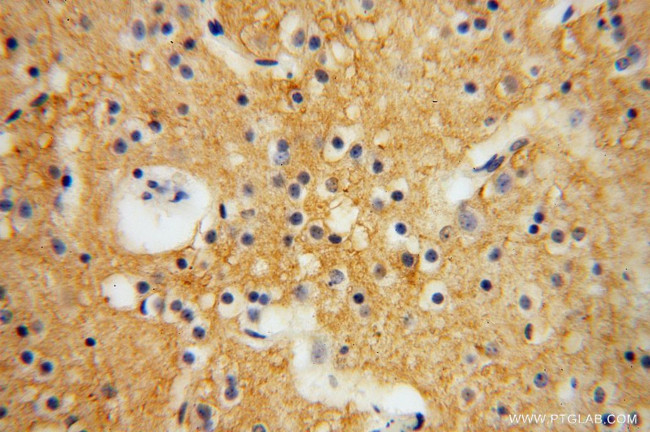 PCDHA5 Antibody in Immunohistochemistry (Paraffin) (IHC (P))