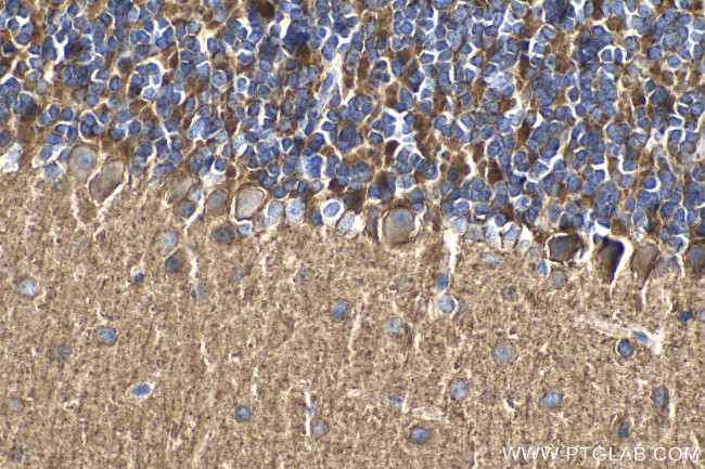 PCDHA5 Antibody in Immunohistochemistry (Paraffin) (IHC (P))