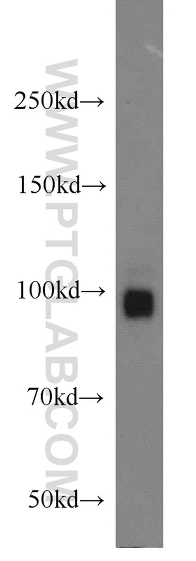 PCDHA5 Antibody in Western Blot (WB)