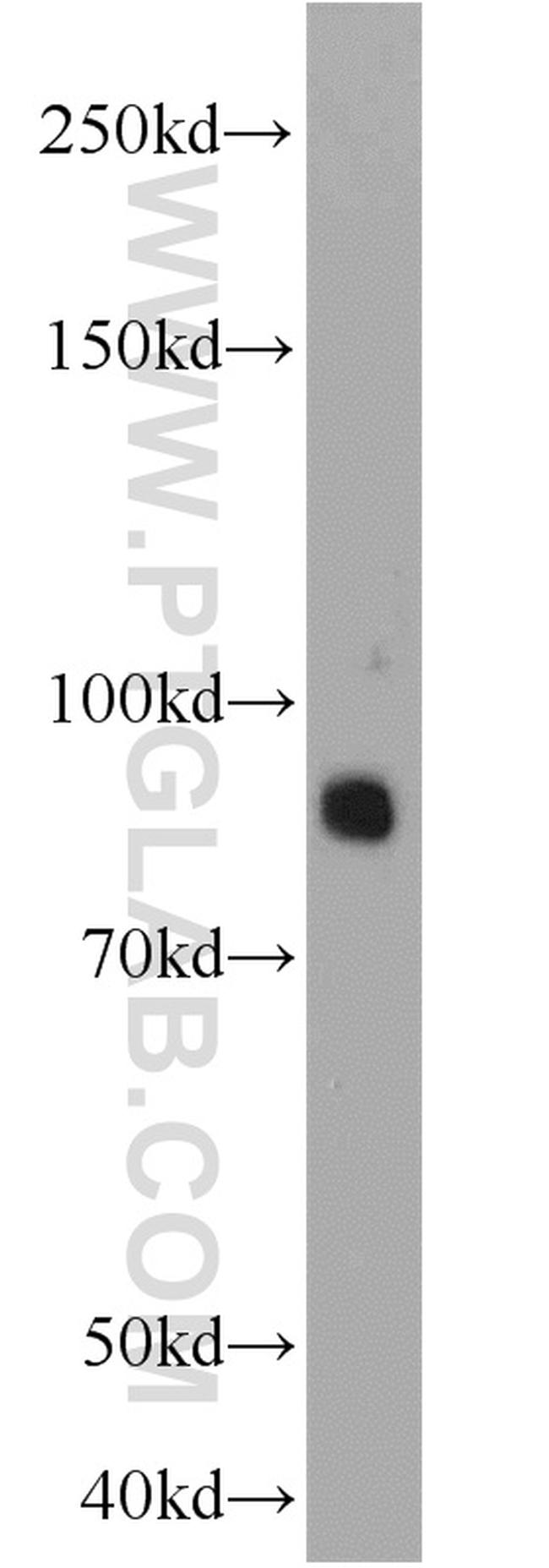 PCDHA5 Antibody in Western Blot (WB)