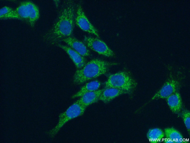 MRPL9 Antibody in Immunocytochemistry (ICC/IF)