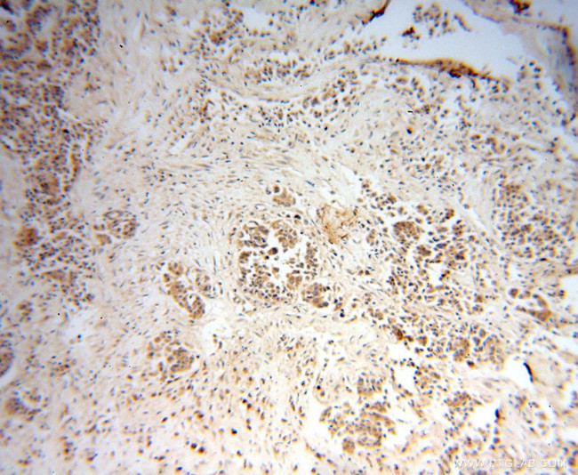 MRPL9 Antibody in Immunohistochemistry (Paraffin) (IHC (P))