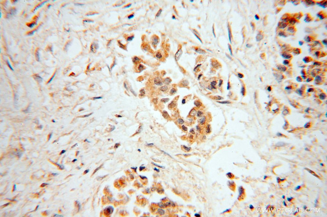 MRPL9 Antibody in Immunohistochemistry (Paraffin) (IHC (P))