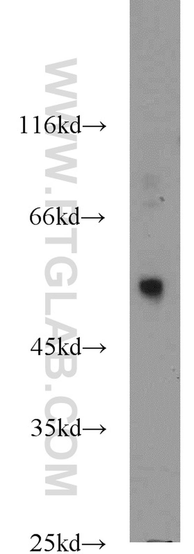 PPAT Antibody in Western Blot (WB)