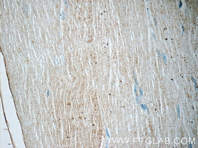 PPARA Antibody in Immunohistochemistry (Paraffin) (IHC (P))