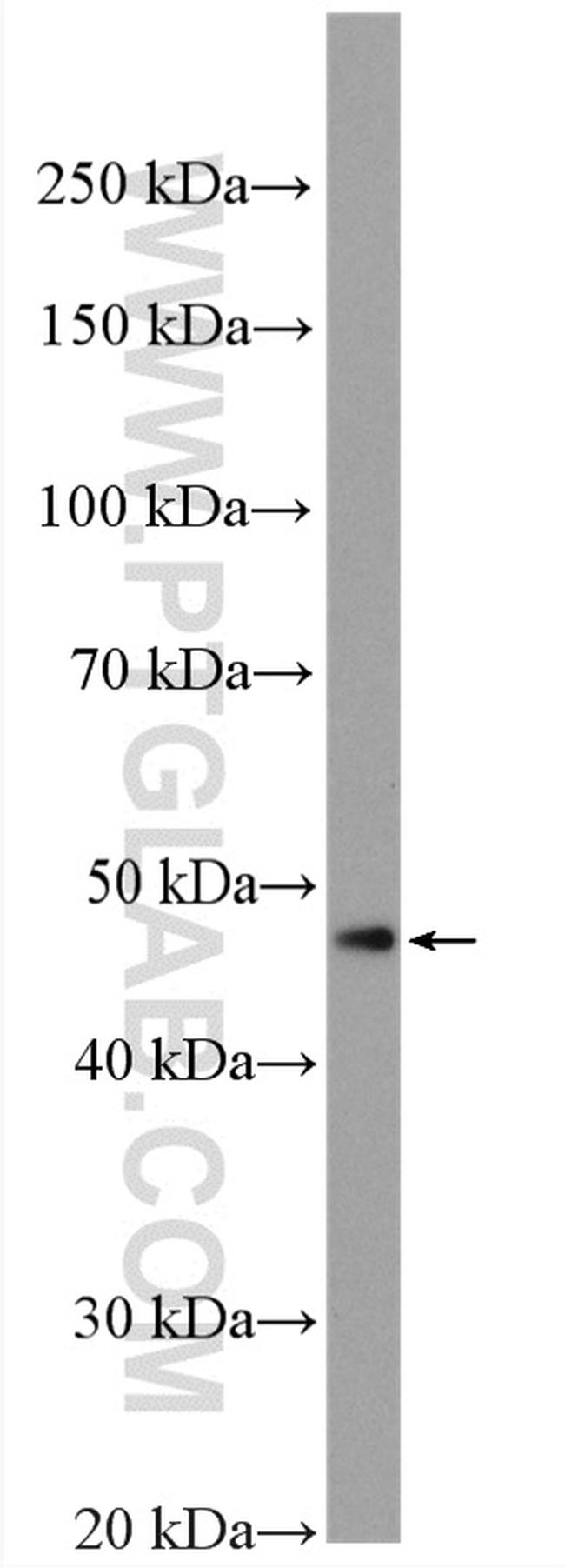 PPARA Antibody in Western Blot (WB)