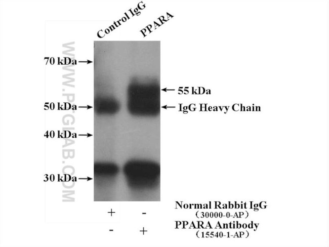 PPARA Antibody in Immunoprecipitation (IP)