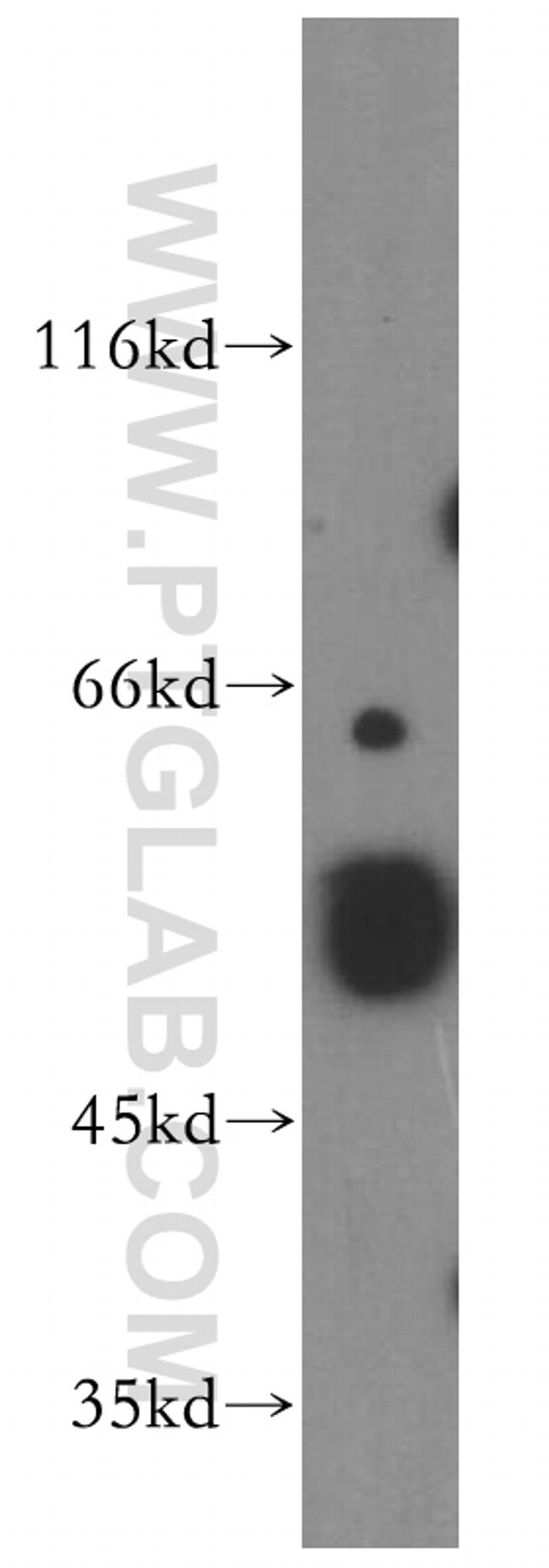 PPARA Antibody in Western Blot (WB)