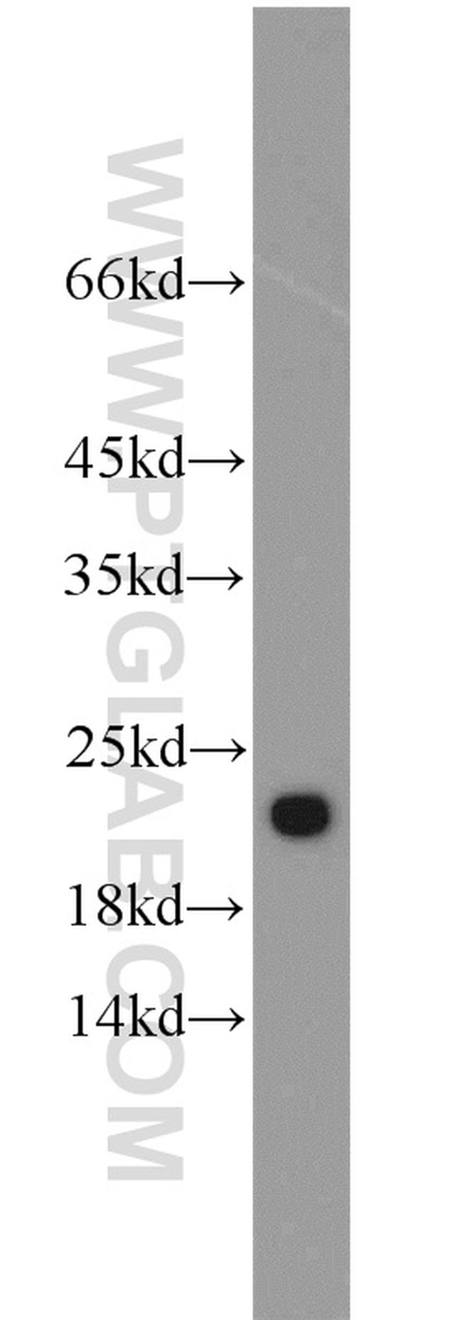 TRAPPC3 Antibody in Western Blot (WB)