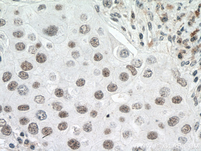 U2AF65 Antibody in Immunohistochemistry (Paraffin) (IHC (P))