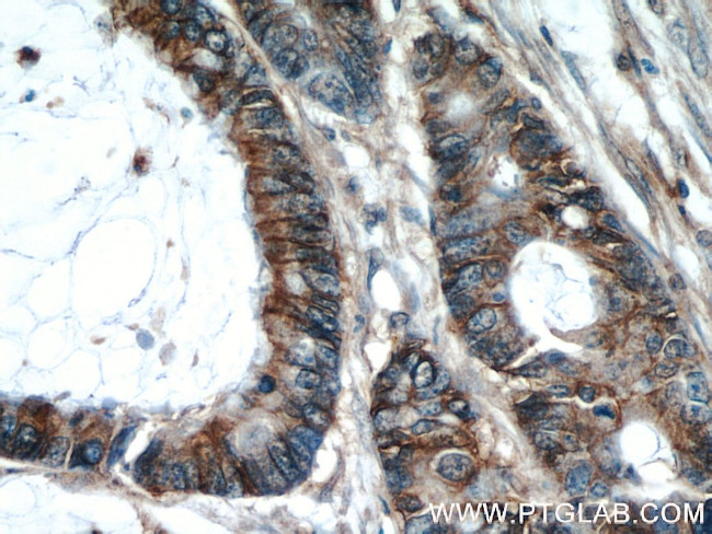 CD44 Antibody in Immunohistochemistry (Paraffin) (IHC (P))