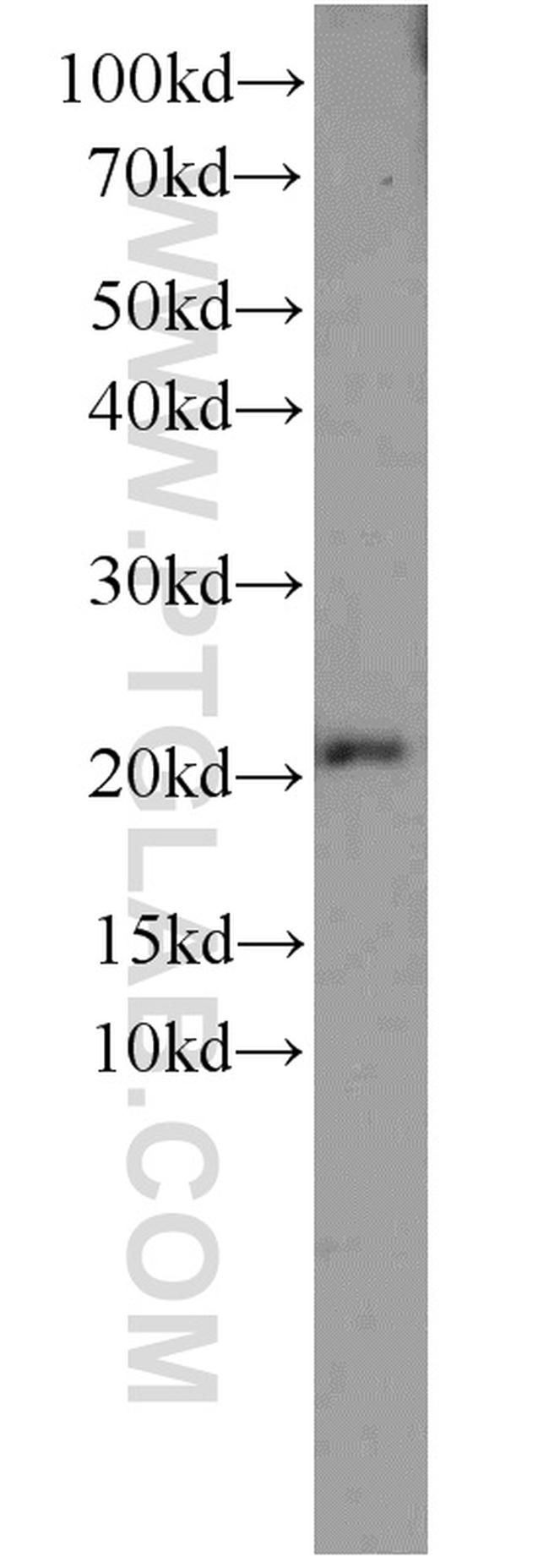 TNFAIP8 Antibody in Western Blot (WB)