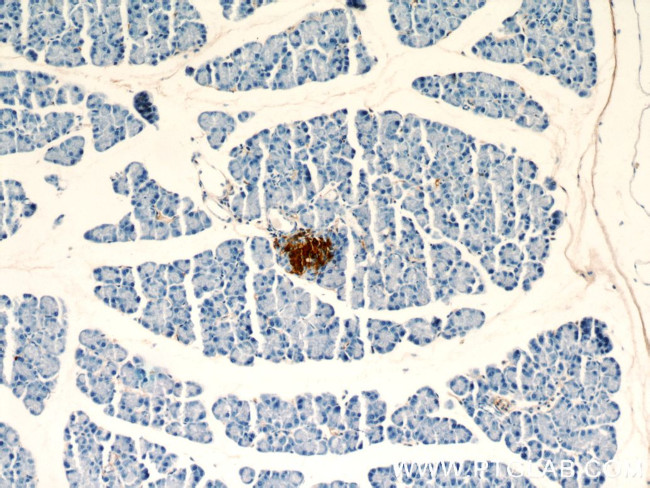 Insulin Antibody in Immunohistochemistry (Paraffin) (IHC (P))