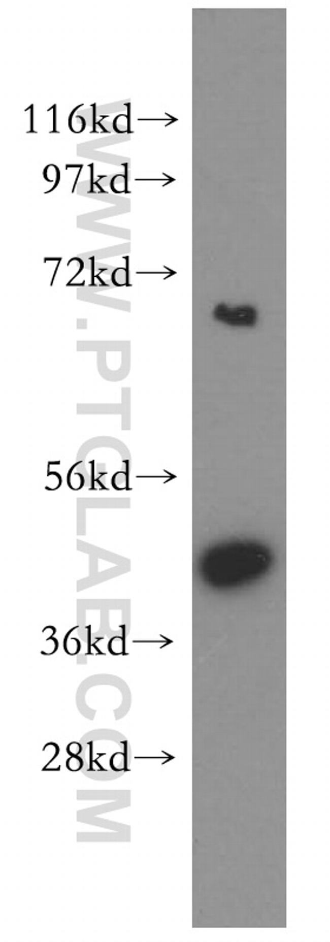 ART3 Antibody in Western Blot (WB)