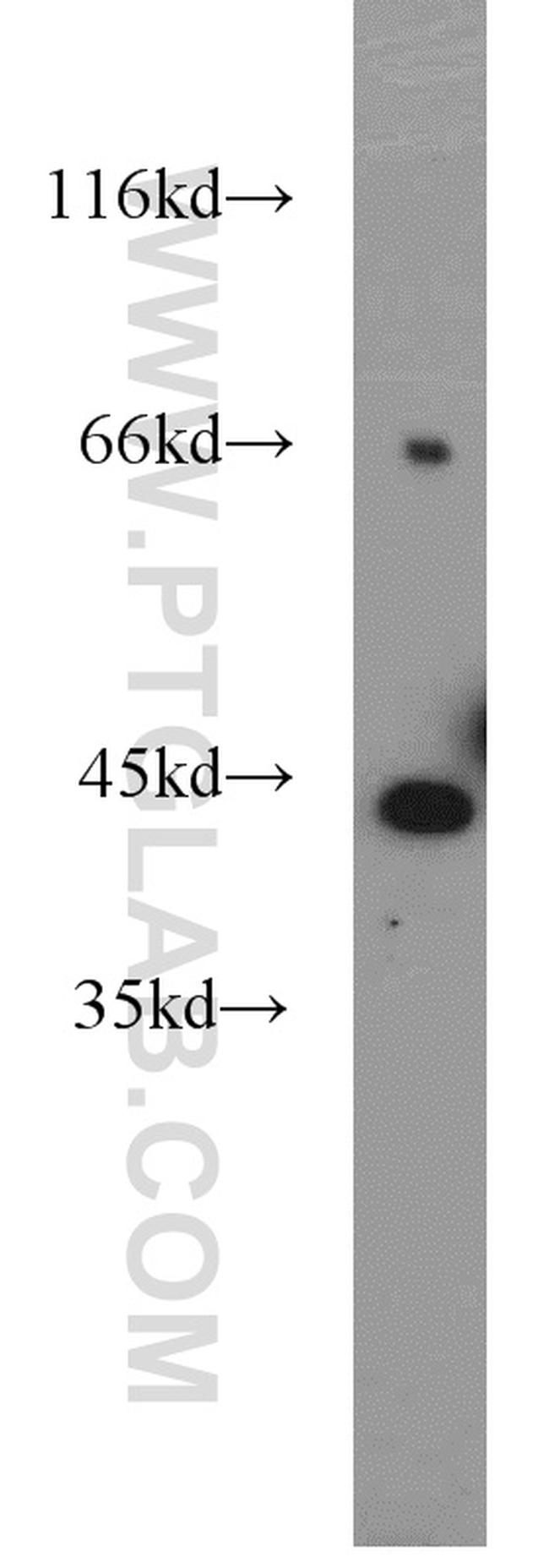 ART3 Antibody in Western Blot (WB)