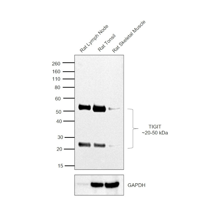 TIGIT Antibody