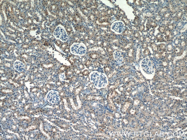 ARG1 Antibody in Immunohistochemistry (Paraffin) (IHC (P))