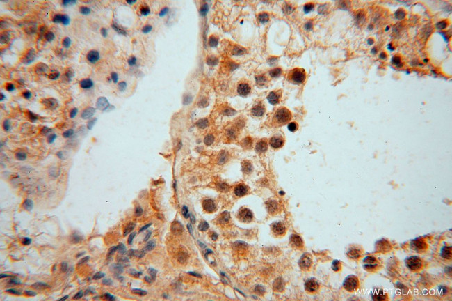 ARG1 Antibody in Immunohistochemistry (Paraffin) (IHC (P))