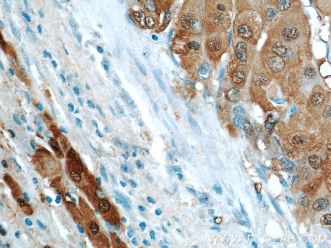 ARG1 Antibody in Immunohistochemistry (Paraffin) (IHC (P))