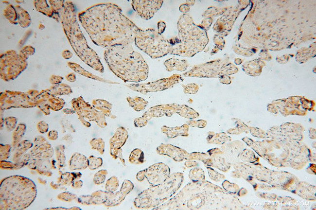 ARG1 Antibody in Immunohistochemistry (Paraffin) (IHC (P))