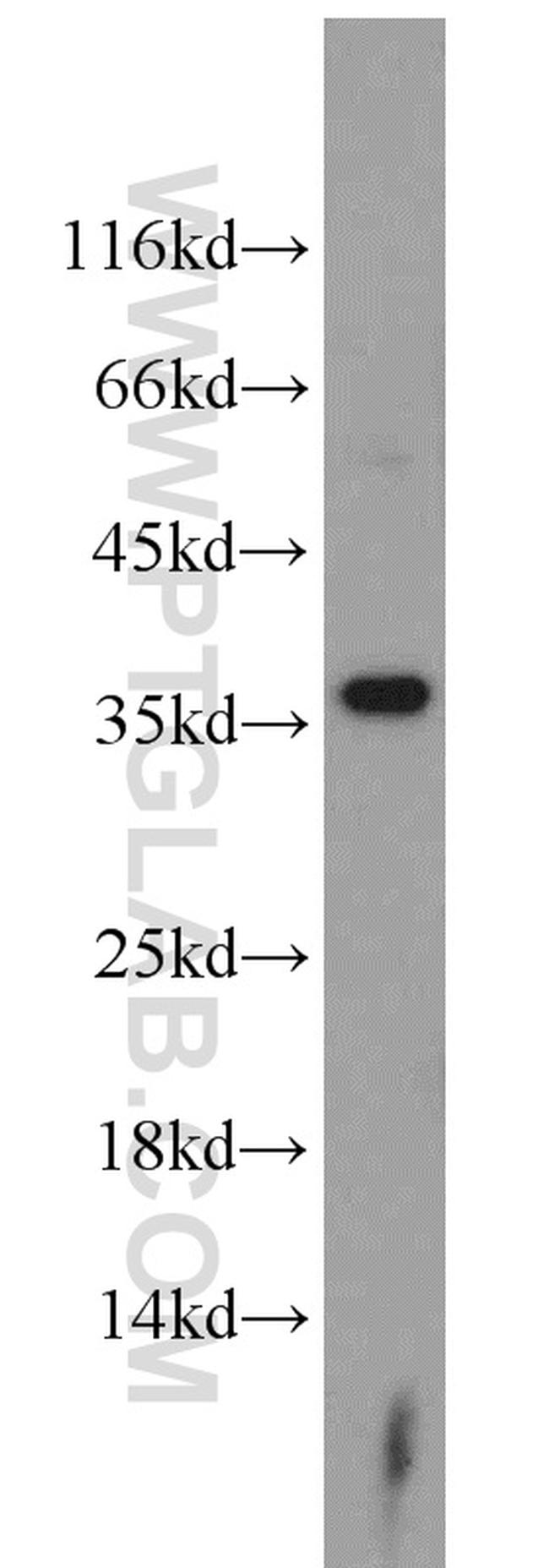 ARG1 Antibody in Western Blot (WB)