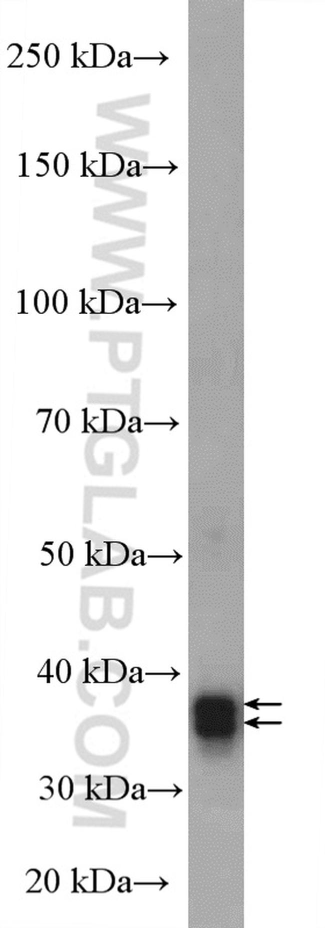 ARG1 Antibody in Western Blot (WB)