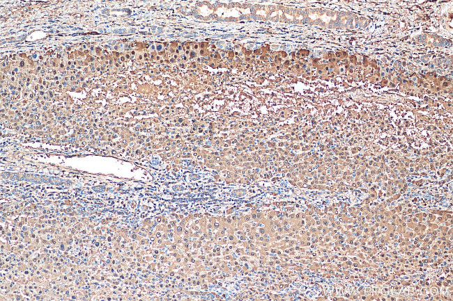 ARG1 Antibody in Immunohistochemistry (Paraffin) (IHC (P))