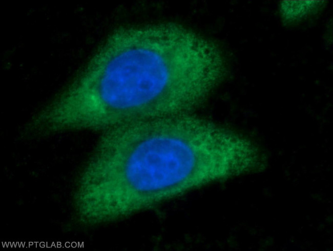 ARG1 Antibody in Immunocytochemistry (ICC/IF)