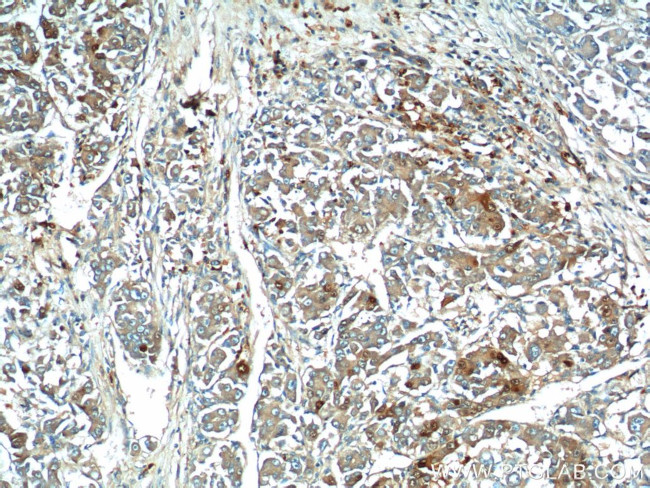 ARG1 Antibody in Immunohistochemistry (Paraffin) (IHC (P))